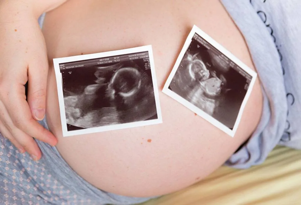 जुळ्या बाळांची गर्भधारणा होण्यासाठी काय करावे?
