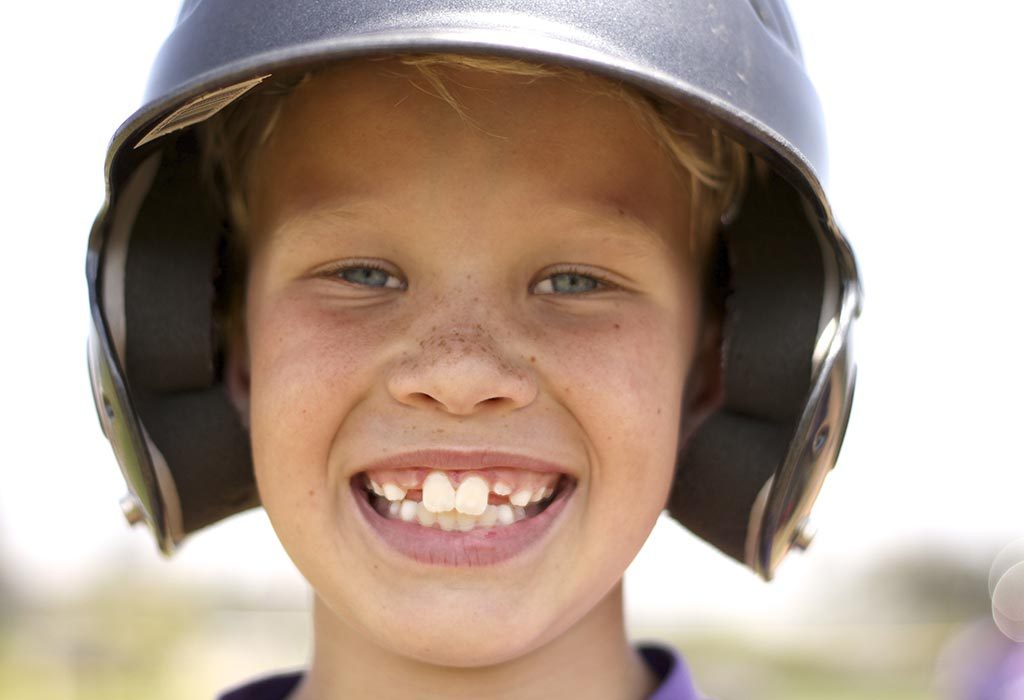 Buck Teeth in Kids – Causes and Treatment
