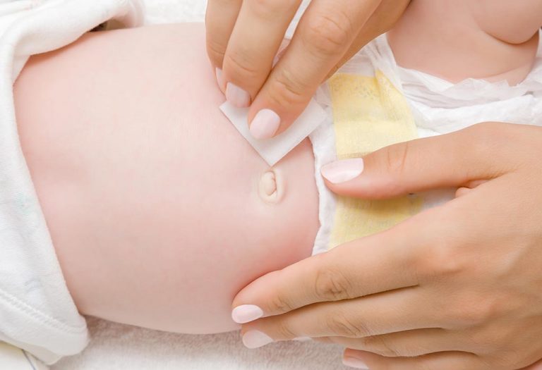 Newborn Belly Button Bleeding - Causes and Caring Tips