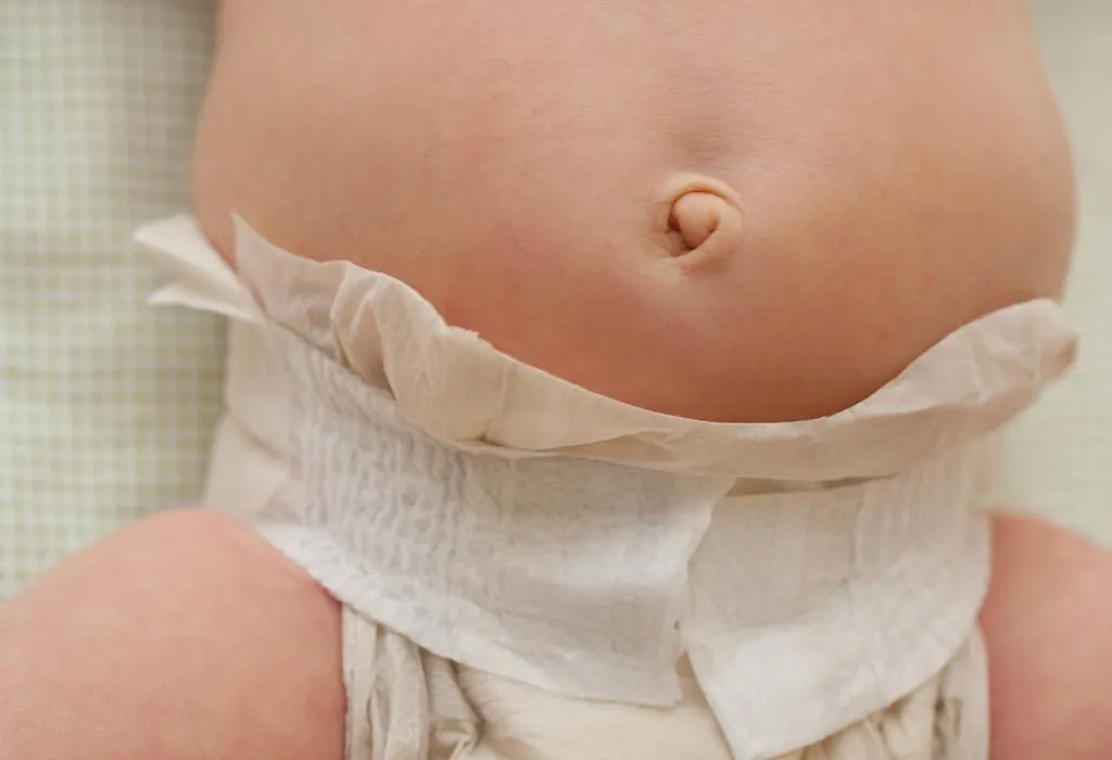 Bleeding belly button newborn