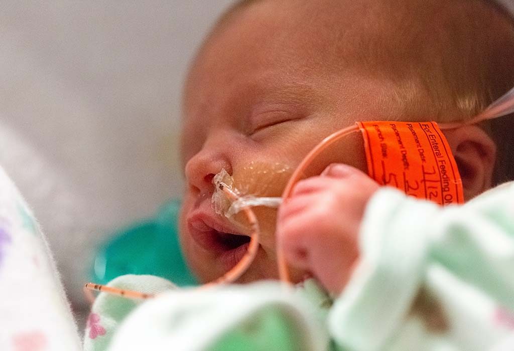 Feeding Tubes for Preemies: Types & Usage & Risks