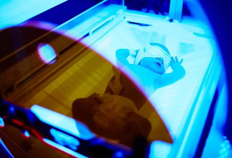 Using Phototherapy for Treating Neonatal Jaundice