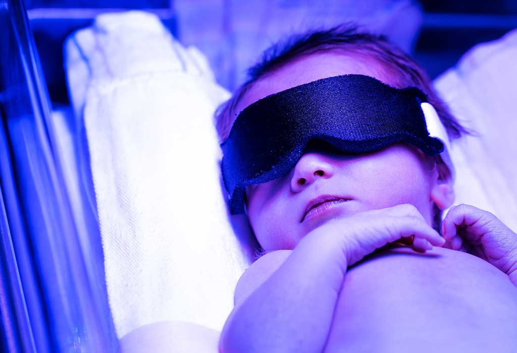 Phototherapy for Treating Neonatal Jaundice Process, Risks & Complications