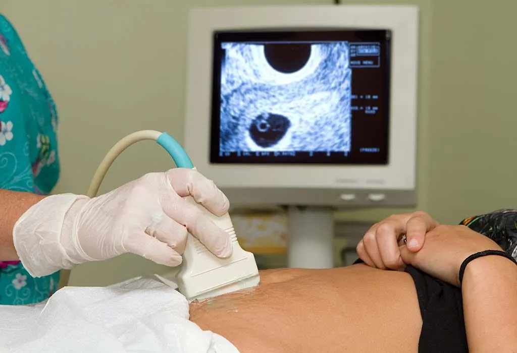 sonography before abortion