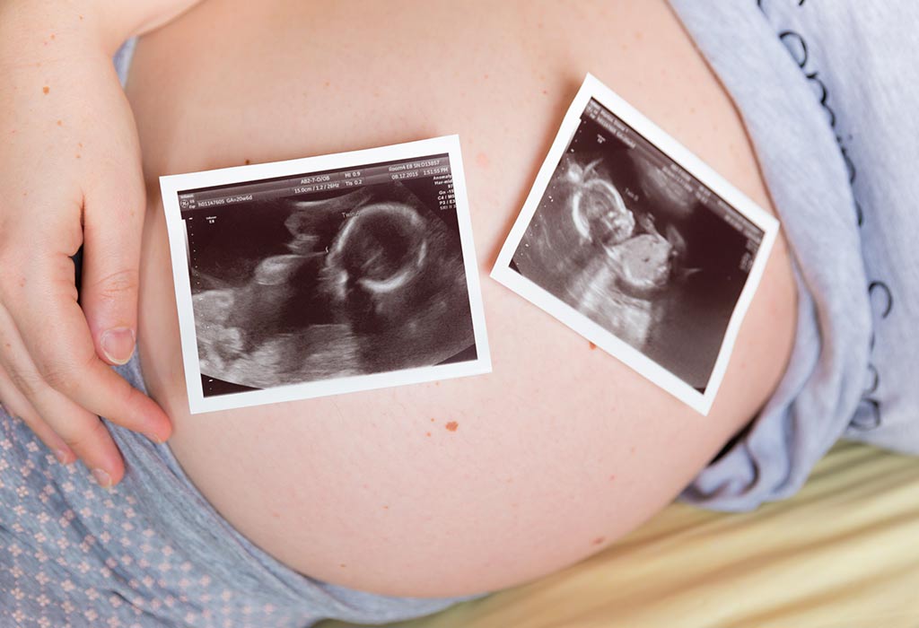 जुळ्या किंवा एकाधिक बाळांसह गरोदरपण - २४ वा आठवडा