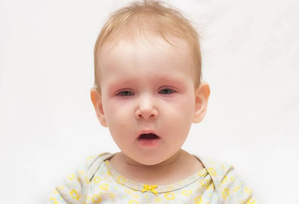 बाळांच्या छातीत कफ होणे: कारणे, लक्षणे आणि घरगुती उपाय