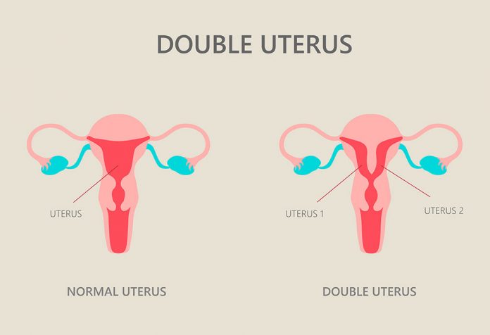 double-uterus-reasons-symptoms-diagnosis-complications