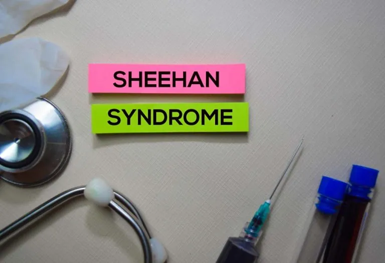 Sheehan's Syndrome (Excessive Bleeding During Childbirth)