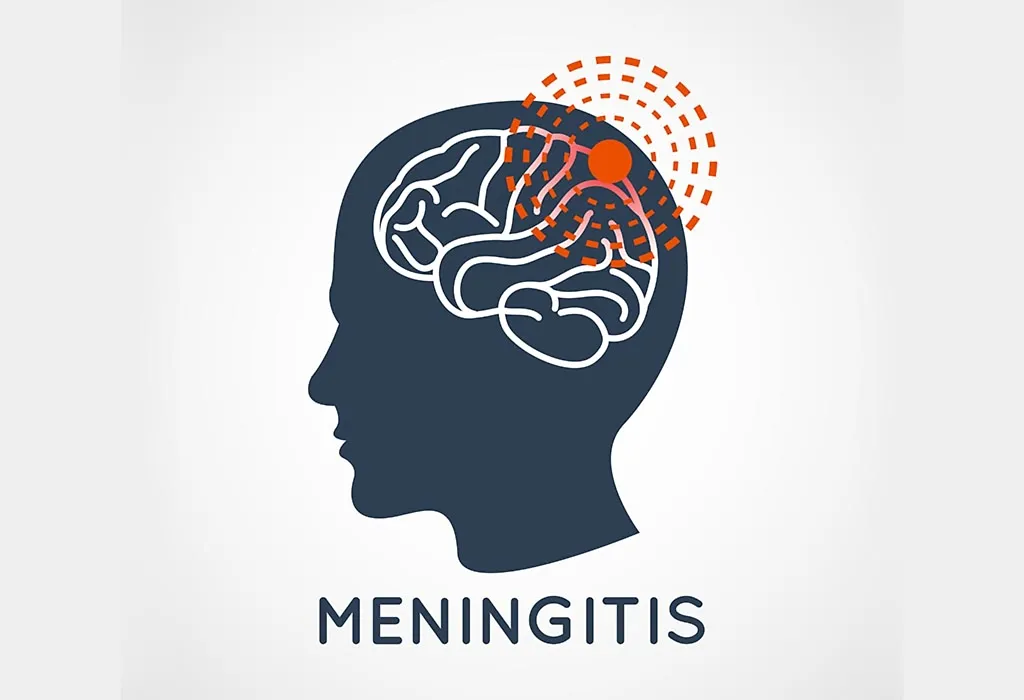 Here’s What You Need To Know About Meningitis