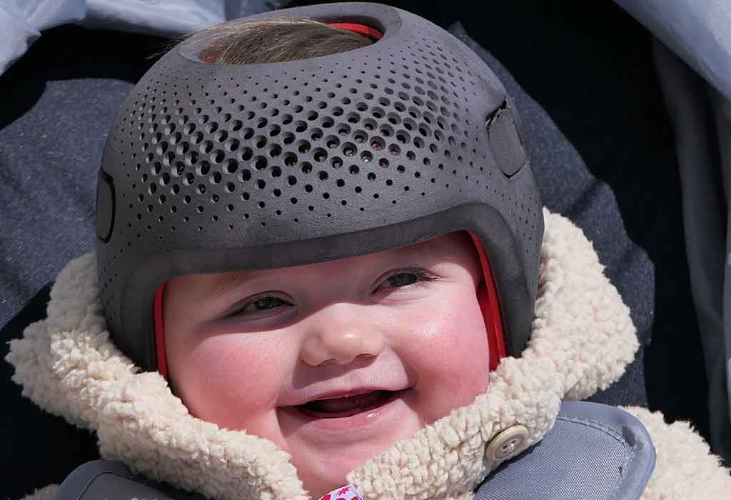Why Do Some Babies Need to Wear a Helmet