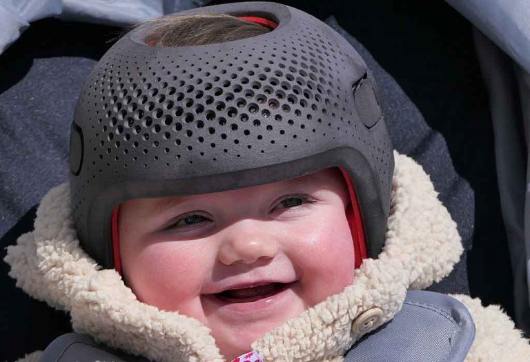 Baby Helmet Therapy: Why Do Babies Wear Helmets?