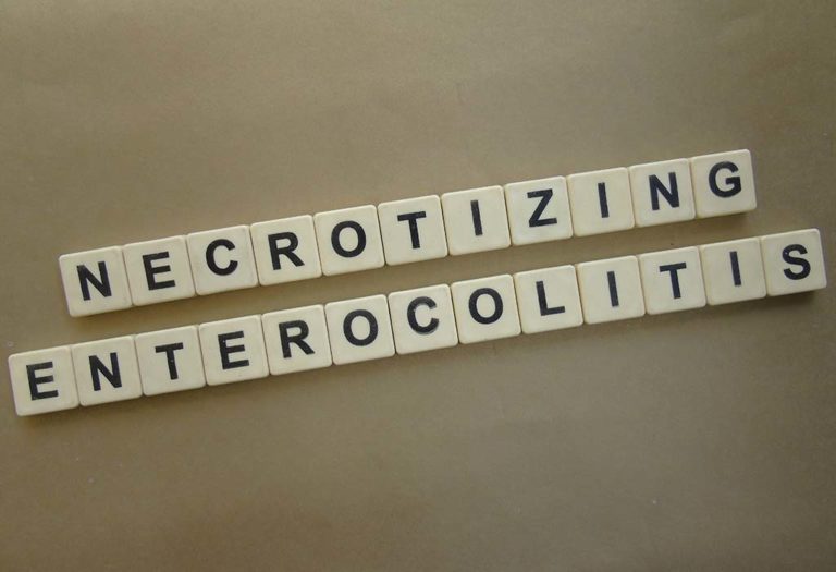 Necrotizing Enterocolitis in Babies - Causes, Symptoms, and Treatment