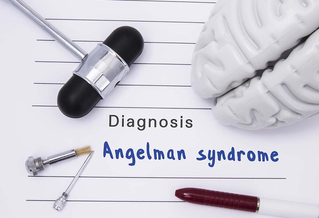 How Is Angelman Syndrome Treated in Young Children?