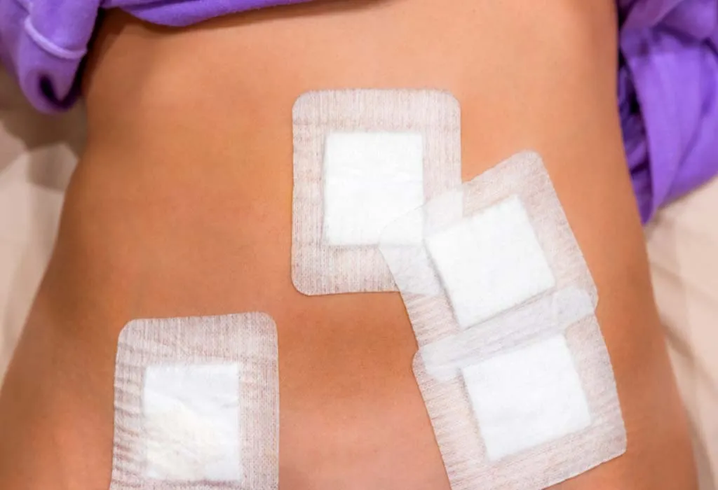 Chromotubation Treatment