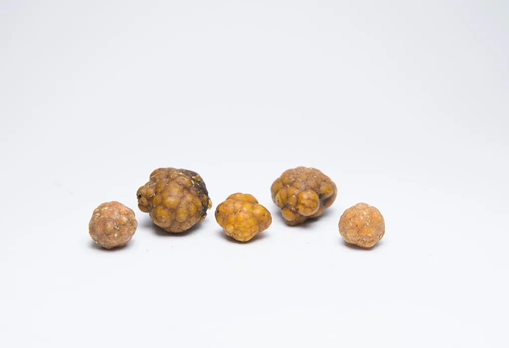 Gallbladder Stones in Pregnancy