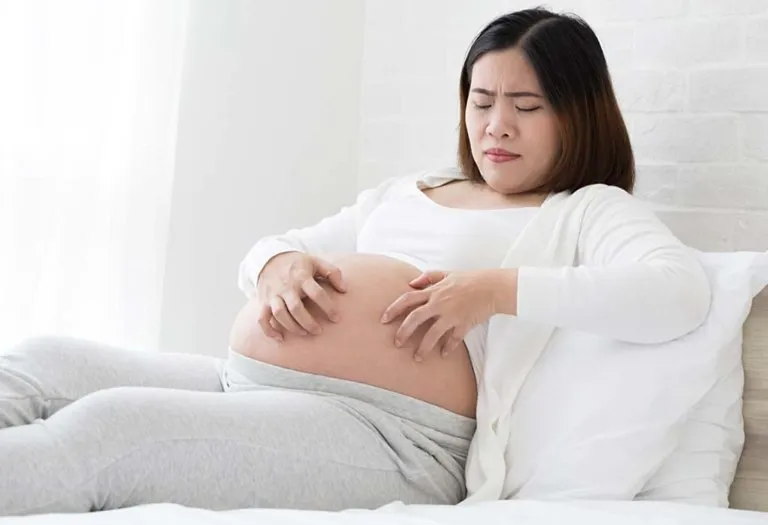 PUPPP Rash During Pregnancy - Causes, Symptoms, and Treatment