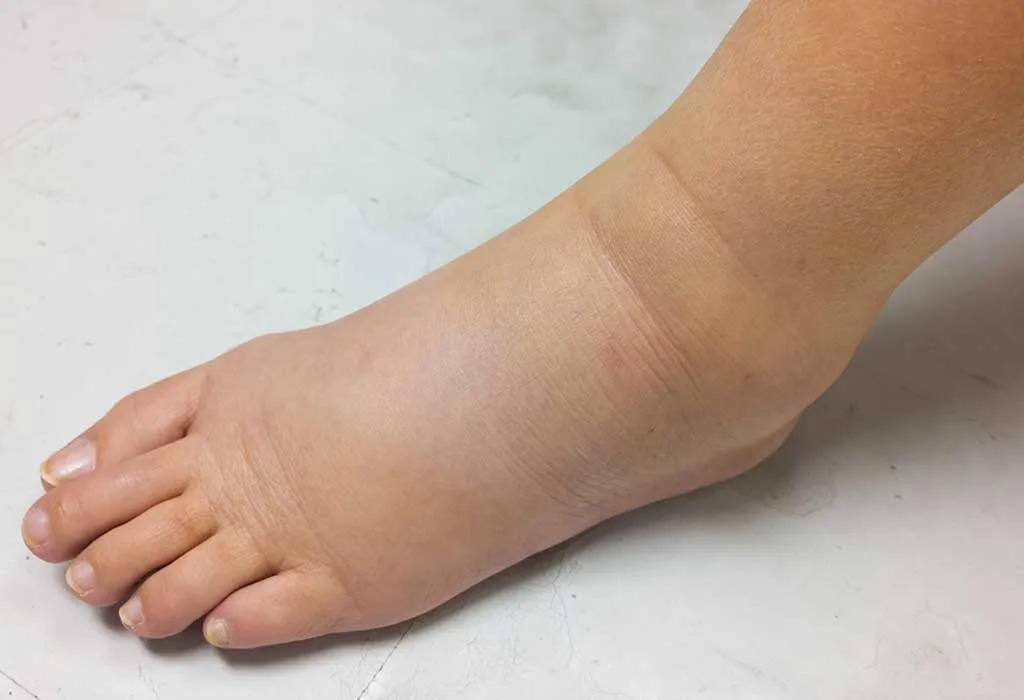 What Are the Risks of Taking an IV?