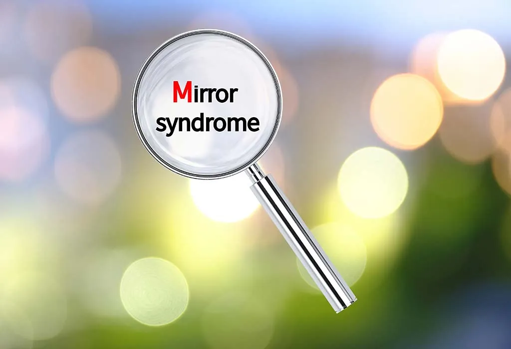 Mirror Syndrome During Pregnancy – Causes, Symptoms, and Treatment
