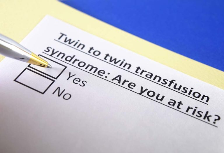 Twin-to-twin Transfusion Syndrome - Stages, Causes, and Symptoms