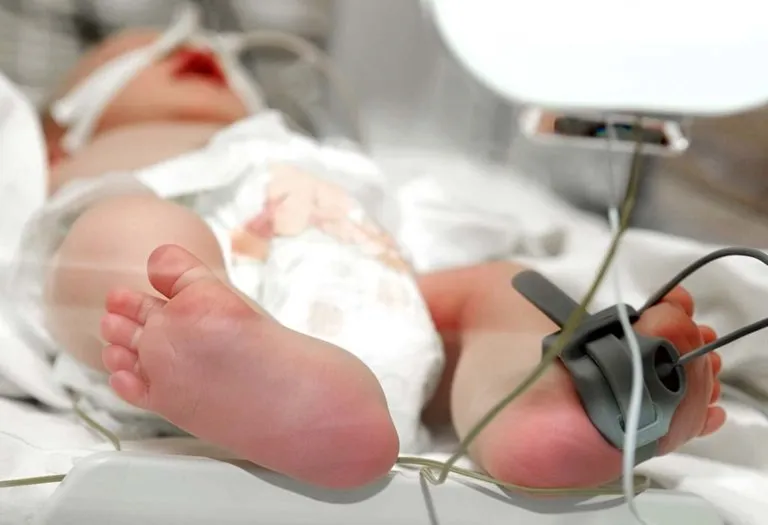 An Open Heart Surgery Survivor