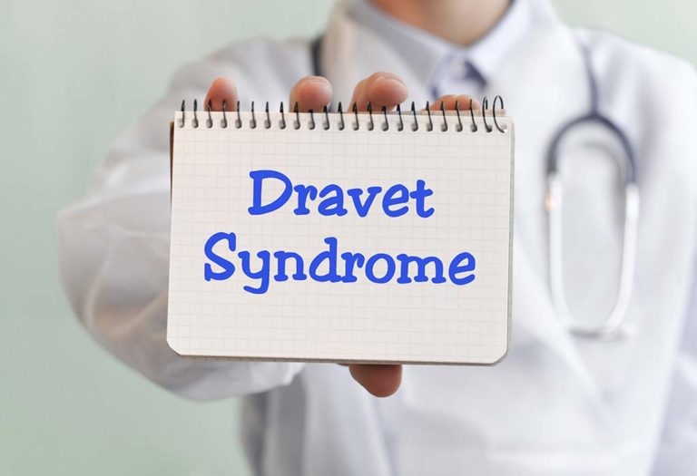 Dravet Syndrome in Babies – Causes, Symptoms, and Treatment