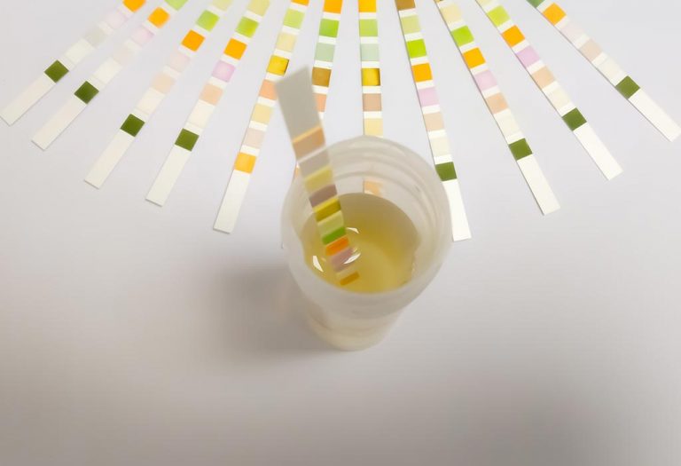 Protein in Child's Urine (Proteinuria) - Reasons, Risks, Treatment and Prevention