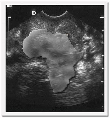 Ultrasound