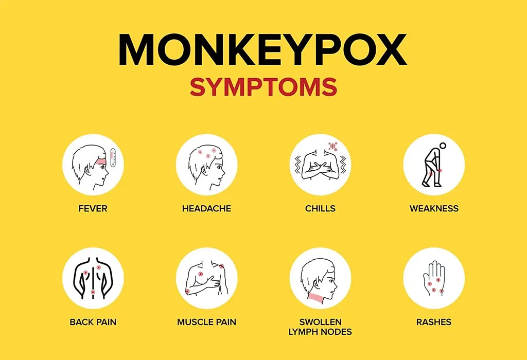 Symptoms of Monkeypox