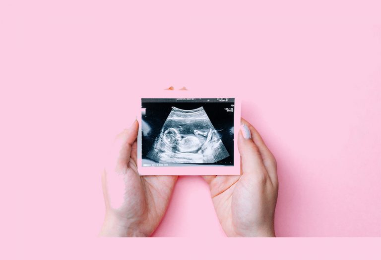 Effective Ways on How to Prevent Autism During Pregnancy