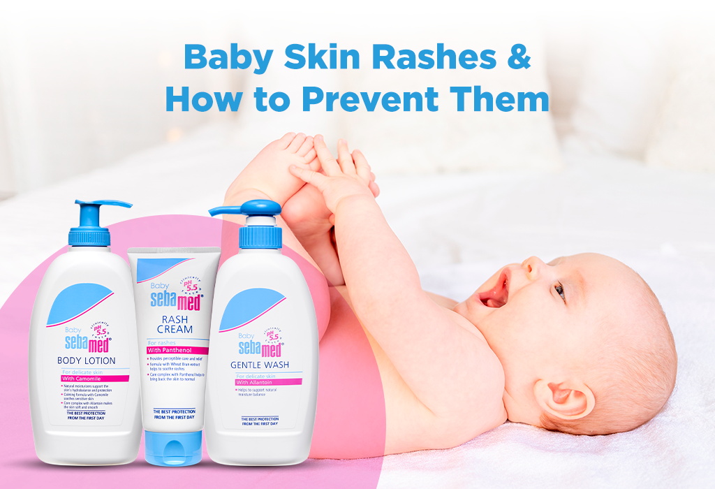 Baby’s Skin Rash – Causes, Treatment & Prevention Tips