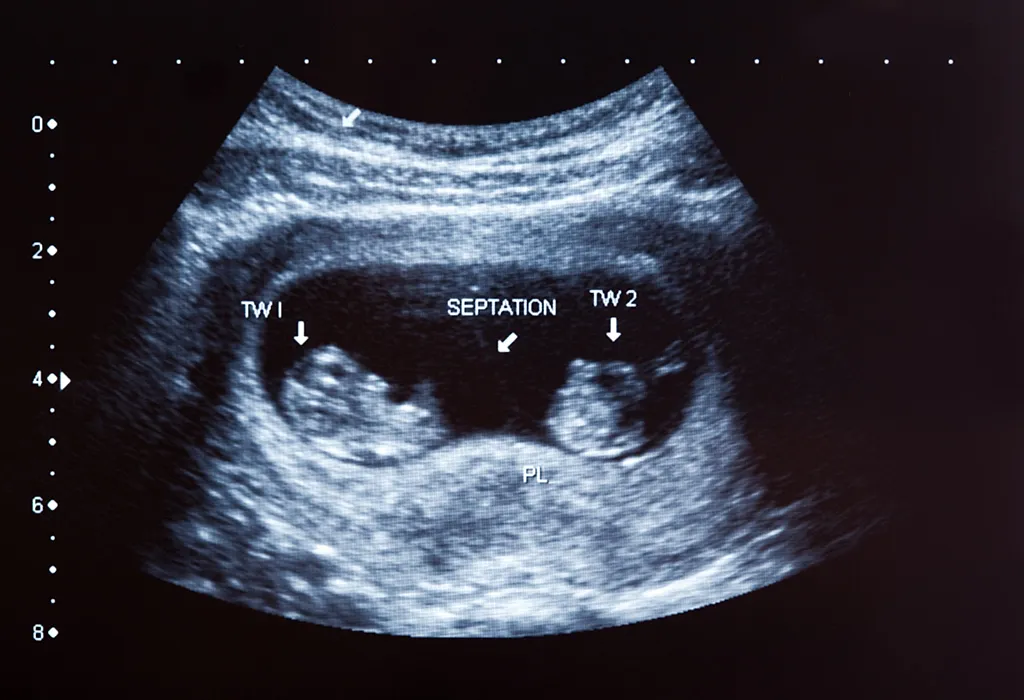 एचसीजी किती वेळा वाढते