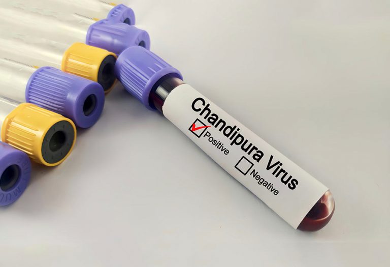 Chandipura Virus - How to Protect Your Child!
