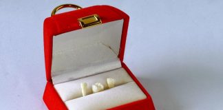 बच्चे के दूध के दांत क्यों और कैसे संभालकर रखें | Bacche Ke Doodh Ke Dant Kyon Aur Kaise Sambhalkar Rakhe