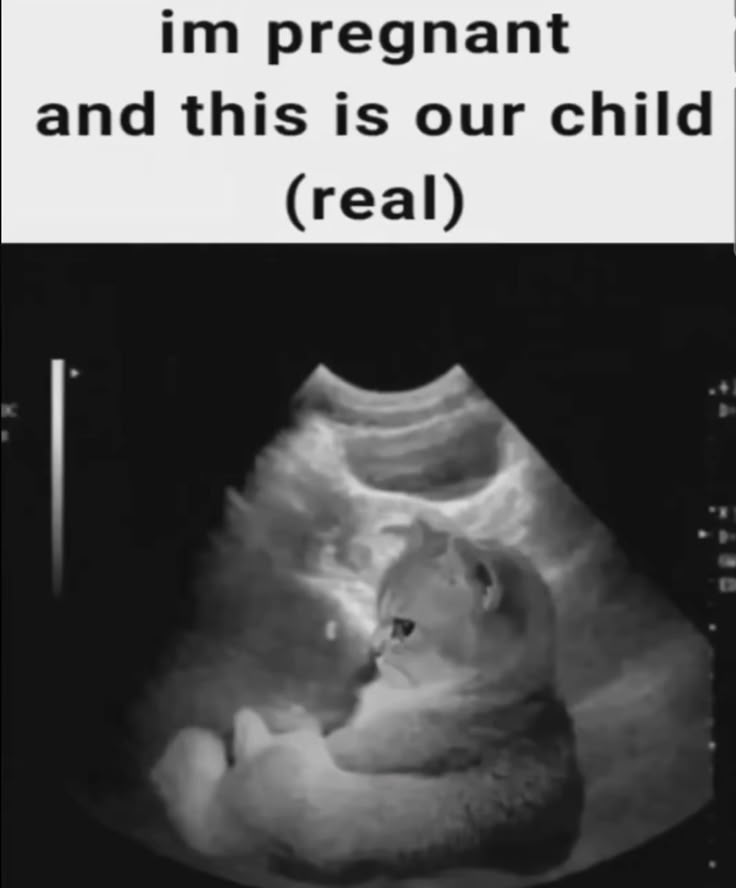 pregnancy meme
