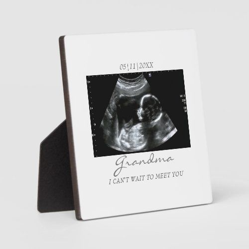 Custom Ultrasound Keepsake Frame
