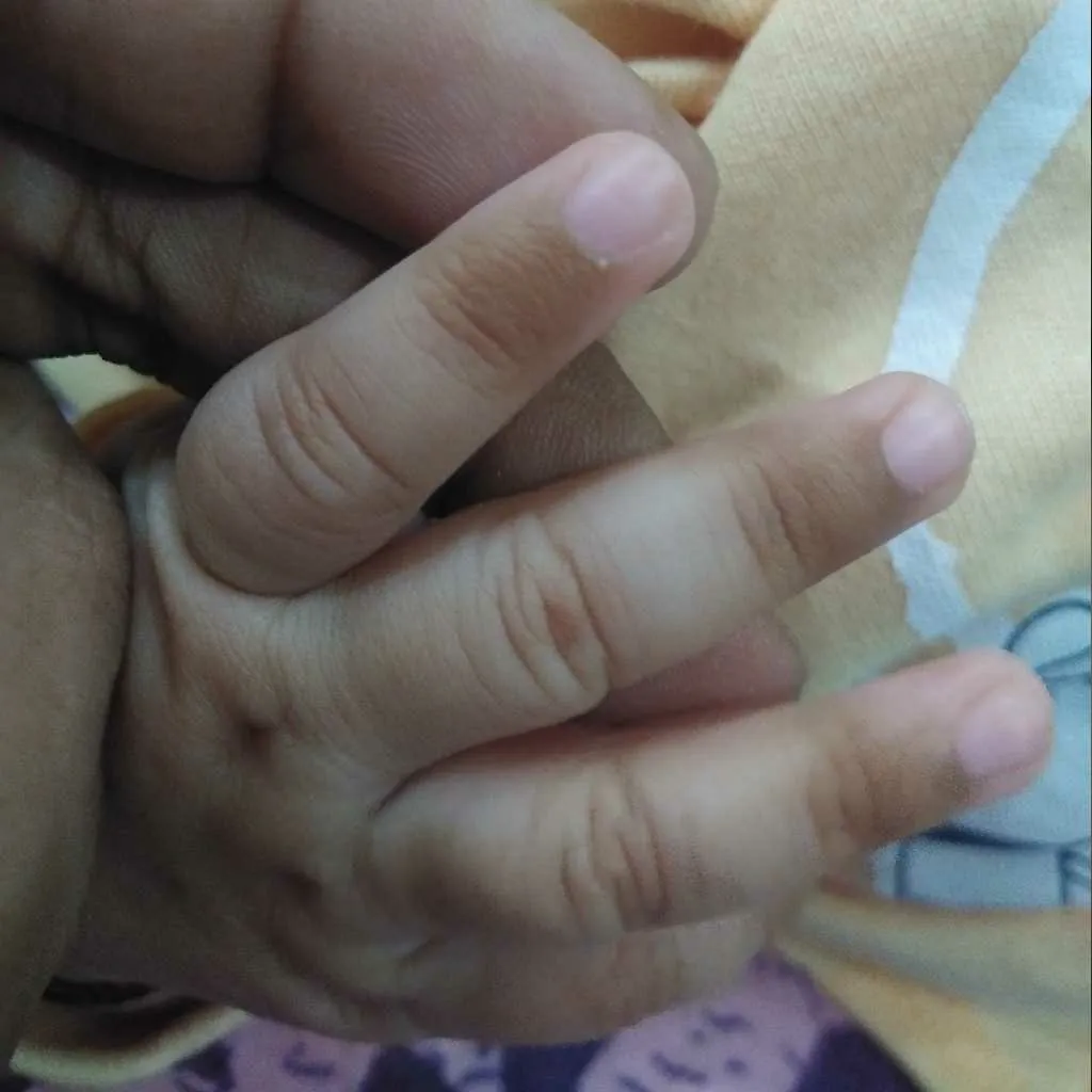 8weeks old baby girls skin near nails getting darker. wht is the   there ny concern? – FirstCry Parenting