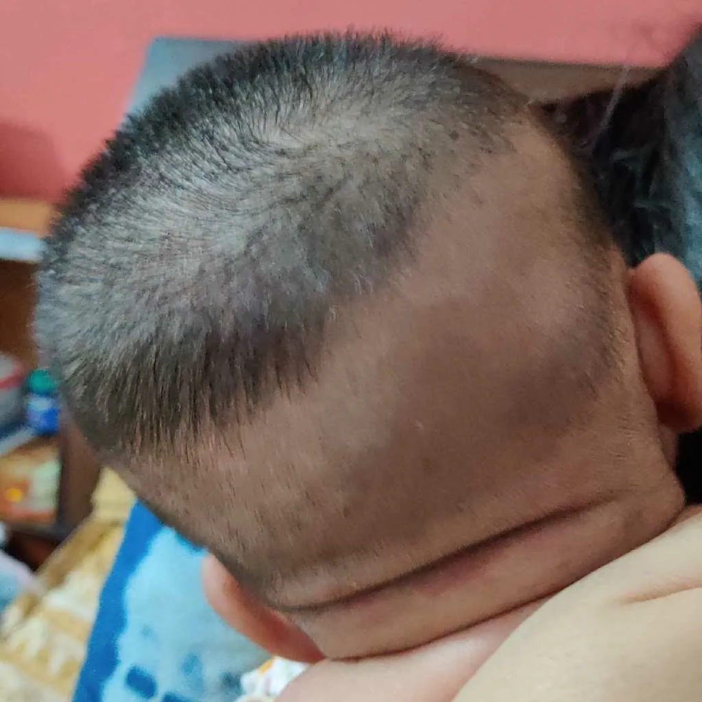 my 02 month old daughter has very thin hair on the hindside of the head.  the thinness is also on the sides and front.. is it a thing to  worry...what' should we