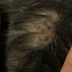 Hi my baby is having small black dots on her scalp. Is it safe or some  problem is there? – FirstCry Parenting